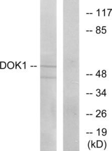 Western blot analysis of lysates from Jurkat cells using Anti-p62 Dok Antibody. The right hand lane represents a negative control, where the antibody is blocked by the immunising peptide.