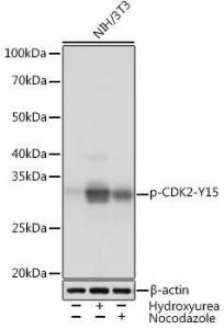 Western blot analysis of extracts of NIH/3T3 cells, using Anti-CDK2 (phospho Tyr15) Antibody [ARC1550] (A306143) at 1:1000 dilution. NIH/3T3 cells were treated by Hydroxyurea (4 Mm) at 37°C for 20 hours or treated by Nocodazole (100 ng/ml) at 37°C for 24 hours