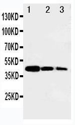 Anti-B MyB Rabbit Polyclonal Antibody