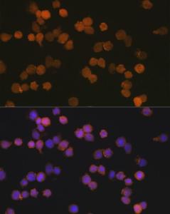 Immunofluorescence analysis of THP-1 cells using Anti-Iba1 Antibody [ARC2301] (A307823) at a dilution of 1:100 (40x lens). DAPI was used to stain the cell nuclei (blue).