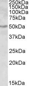 Anti-ALDH9A1 Antibody (A84830) (0.3 µg/ml) staining of Human Kidney lysate (35 µg protein in RIPA buffer). Primary incubation was 1 hour. Detected by chemiluminescence