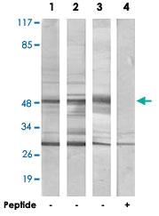 Anti-HNRNPH2 Rabbit Polyclonal Antibody