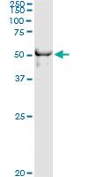 Anti-DYX1C1 Antibody Pair