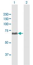 Anti-CFHR5 Rabbit Polyclonal Antibody