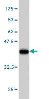 Anti-CMAS Mouse Monoclonal Antibody [clone: 5A2]