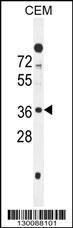 Anti-SFR1 Rabbit Polyclonal Antibody (HRP (Horseradish Peroxidase))