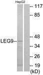 Anti-Galectin-9 Rabbit polyclonal antibody