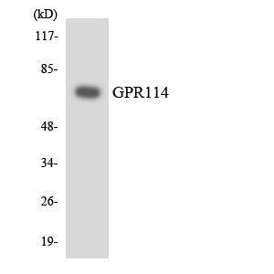 Western blot analysis of the lysates from 293 cells using Anti-GPR114 Antibody