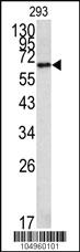 Anti-METAP2 Rabbit Polyclonal Antibody