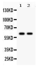 Anti-CYP1B1 Rabbit Polyclonal Antibody