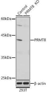 Western blot analysis of extracts from normal (control) and PRMT8 Rabbit polyclonal antibody knockout (KO) 293T cells, using Anti-PRMT8 Antibody (A309061) at 1:1,000 dilution