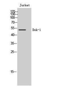 Western blot analysis of Jurkat cells using Anti-p62 Dok Antibody