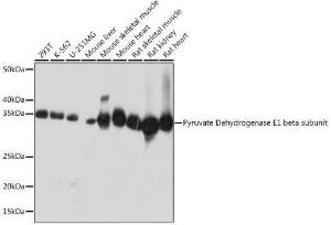 Western blot analysis of extracts of various cell lines, using Anti-PDHB Antibody [ARC1074] (A306144) at 1:1,000 dilution. The secondary antibody was Goat Anti-Rabbit IgG H&L Antibody (HRP) at 1:10,000 dilution.