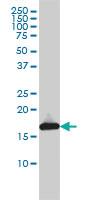 Anti-UBE2L3 Mouse Monoclonal Antibody [clone: 3B7]