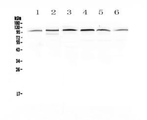 Anti-MVP Polyclonal Antibody