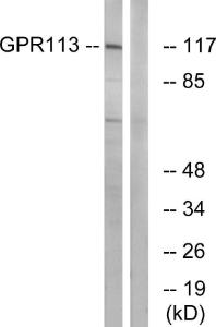 Western blot analysis of lysates from LOVO cells using Anti-GPR113 Antibody. The right hand lane represents a negative control, where the antibody is blocked by the immunising peptide