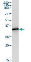 Anti-MS4A1 Polyclonal Antibody Pair