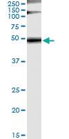 Anti-GRB7 Antibody Pair