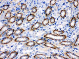 Anti-CYP1B1 Rabbit Polyclonal Antibody