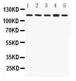 Anti-KAT13D/CLOCK Polyclonal Antibody