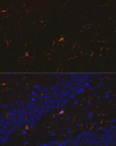 Immunofluorescence analysis of rat brain using Anti-Iba1 Antibody [ARC2301] (A307823) at a dilution of 1:100 (40x lens). DAPI was used to stain the cell nuclei (blue).