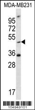 Anti-TPST1 Rabbit Polyclonal Antibody