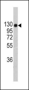 Anti-COL2A1 Rabbit Polyclonal Antibody (FITC (Fluorescein))