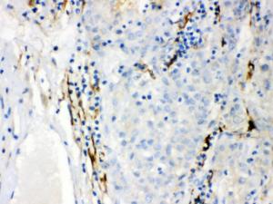 Anti-CYP1B1 Rabbit Polyclonal Antibody