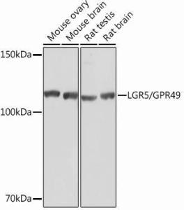 Western blot analysis of extracts of various cell lines, using Anti-LGR5 Antibody [ARC0321] (A309062) at 1:1,000 dilution. The secondary antibody was Goat Anti-Rabbit IgG H&L Antibody (HRP) at 1:10,000 dilution.