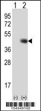 Anti-TPST1 Rabbit Polyclonal Antibody