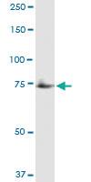 Anti-GUCY1A3 Polyclonal Antibody Pair