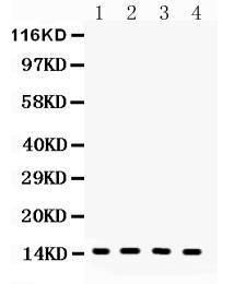 Anti-FABP4/A Fabp Polyclonal Antibody