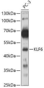 Western blot analysis of extracts of PC-3 cells, using Anti-KLF6 Antibody (A8504) at 1:500 dilution