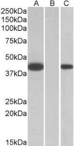 HEK293 lysate (10ug protein in RIPA buffer) overexpressing Human FANCF with C-terminal MYC tag probed with Anti-FANCF Antibody (A84832) (1 µg/ml) in Lane A and probed with <br />anti-MYC Tag (1/1000) in lane C