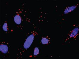 Anti-GSK3B + AXIN1 Antibody Pair