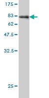 Anti-AKT1 Mouse Monoclonal Antibody [clone: 6G6]