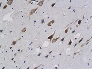 Anti-CNN1 Rabbit Polyclonal Antibody