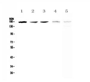 Anti-IRE1 Polyclonal Antibody