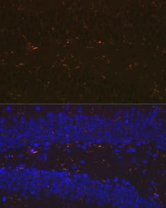 Immunofluorescence analysis of mouse brain using Anti-Iba1 Antibody [ARC2301] (A307823) at a dilution of 1:100 (40x lens). DAPI was used to stain the cell nuclei (blue).