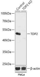 Western blot analysis of extracts from normal (control) and TDP2 knockout (KO) HeLa cells, using Anti-TDP2 Antibody (A92924) at 1:3,000 dilution. The secondary antibody was Goat Anti-Rabbit IgG H&L Antibody (HRP) at 1:10,000 dilution.