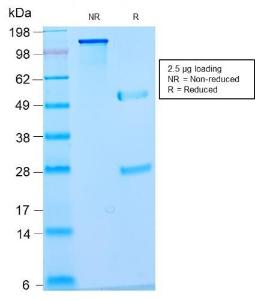 SDS-PAGE analysis of Anti-Nuclear Antigen Antibody [NM2984R] under non-reduced and reduced conditions; showing intact IgG and intact heavy and light chains, respectively. SDS-PAGE analysis confirms the integrity and purity of the antibody