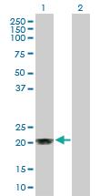 Anti-MGMT Rabbit Polyclonal Antibody