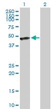 Anti-CALR3 Rabbit Polyclonal Antibody