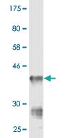 Anti-CMAS Mouse Monoclonal Antibody [clone: 2E1]