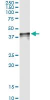 Anti-NOV Antibody Pair