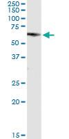 Anti-GRB7 Polyclonal Antibody Pair