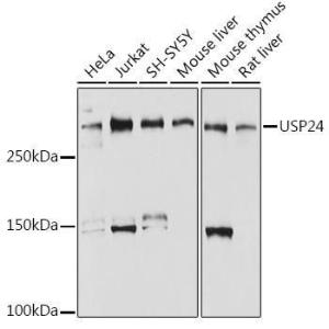 Western blot analysis of extracts of various cell lines, using Anti-USP24 Antibody [ARC2526] (A309063) at 1:1,000 dilution. The secondary antibody was Goat Anti-Rabbit IgG H&L Antibody (HRP) at 1:10,000 dilution.