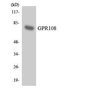 Western blot analysis of the lysates from HT 29 cells using Anti-GPR108 Antibody