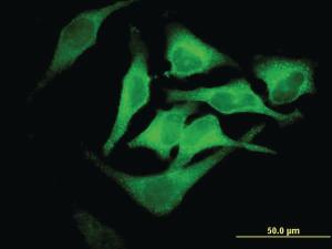 Anti-EPB42 Mouse Monoclonal Antibody [clone: 2G12]