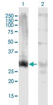 Anti-HOXD13 Mouse Polyclonal Antibody